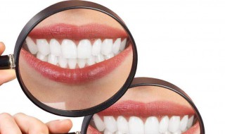 如何让牙齿快速变白（如何让牙齿快速变白没有任何东西）