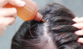 头发贴头皮怎么弄蓬松（冬天头发贴头皮怎么弄蓬松）