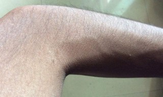 体毛重怎么处理（体毛重怎么处理最好）