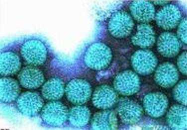 猪病——猪轮状病毒病 猪轮状病毒病的症状