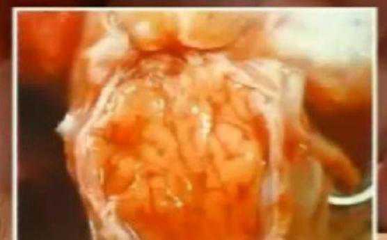 猪病——猪乙型脑炎（猪乙型脑炎症状）