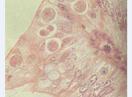 猪病防治--仔猪球虫病（仔猪球虫病的防治）