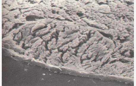 猪住肉孢子虫病 猪住肉孢子虫病图片