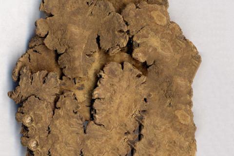 川芎的功效与作用（川芎的功效与作用吃法）