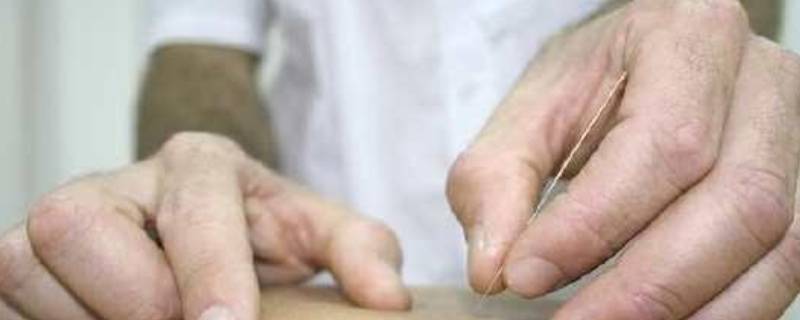 针灸所用的九针是谁发明的 针灸里面的九针是谁发明的
