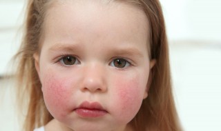 怎样才可以养好皮肤不黑 怎么才能让皮肤黑