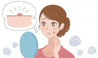 痘痘洗脸洗破了怎么办 洗脸的时候不小心把痘痘洗破怎么办